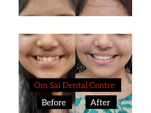 Before and After Treatment
