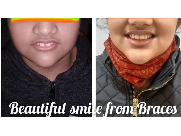 Before and After Treatment