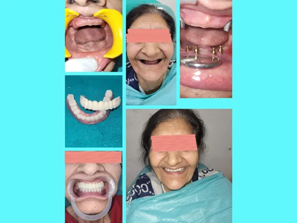 Before and After Treatment