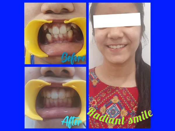 Before and After Treatment