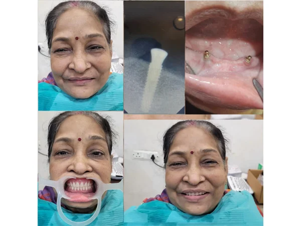 Before and After Treatment