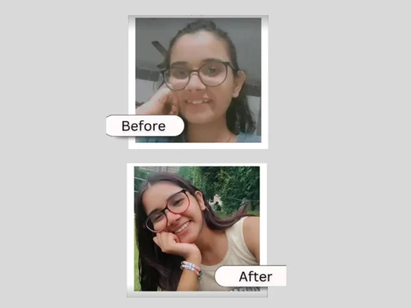 Before and After Treatment