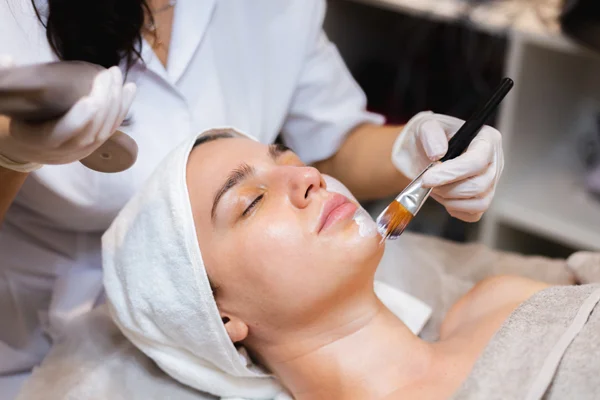 Chemical Peel